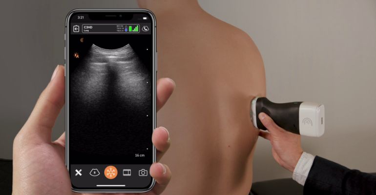 Scanner portátil, sem fio, ultrassonografando o corpo inteiro em minutos