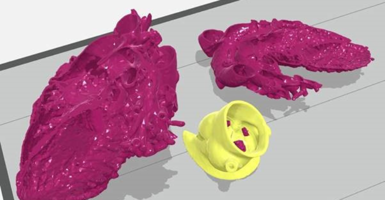 InCor investe em impressão 3D para tratar doenças cardíacas