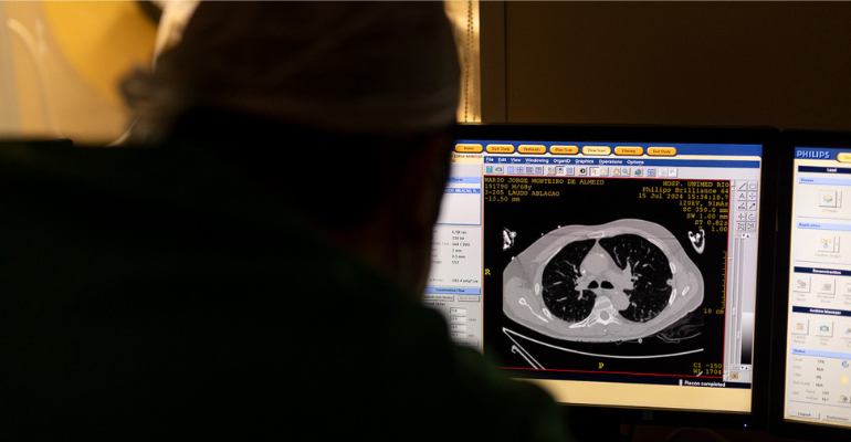 Hospital Unimed realiza primeiro procedimento IceCure no Brasil para tratar tumor pulmonar