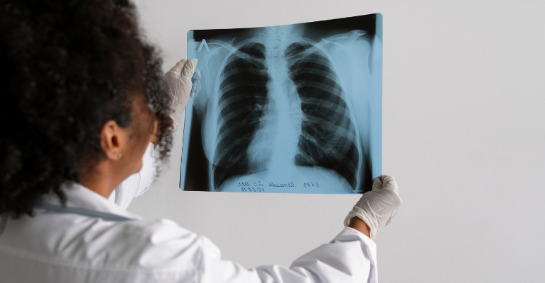 Hospital Alemão Oswaldo Cruz discute os principais avanços no tratamento da doença