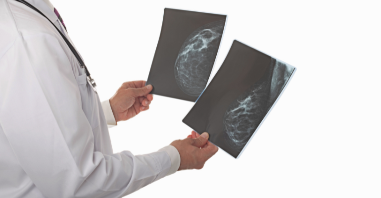 Cirurgia inovadora e IA reduzem impactos no tratamento do câncer de mama