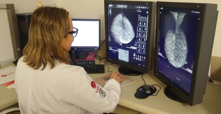 Tomossíntese: método acelera diagnóstico preciso de câncer de mama