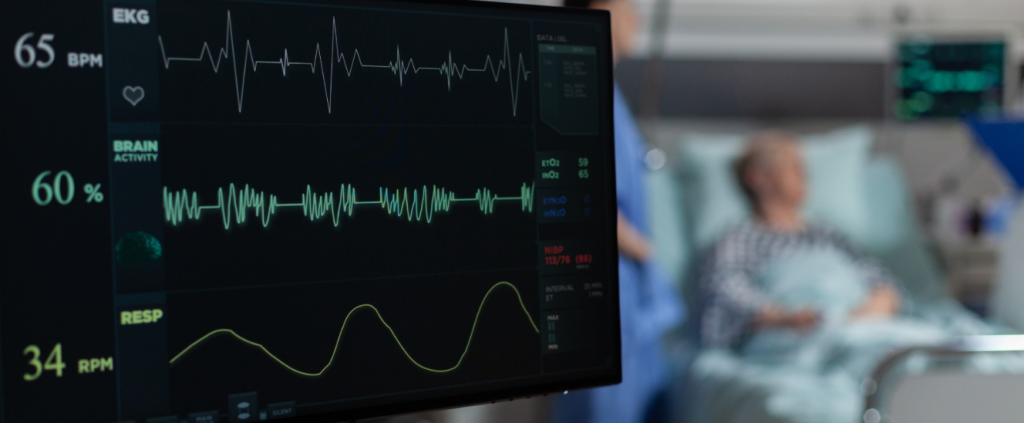 Mater Dei Santa Clara realiza primeira ablação por campo pulsado com mapeamento 3D em MG