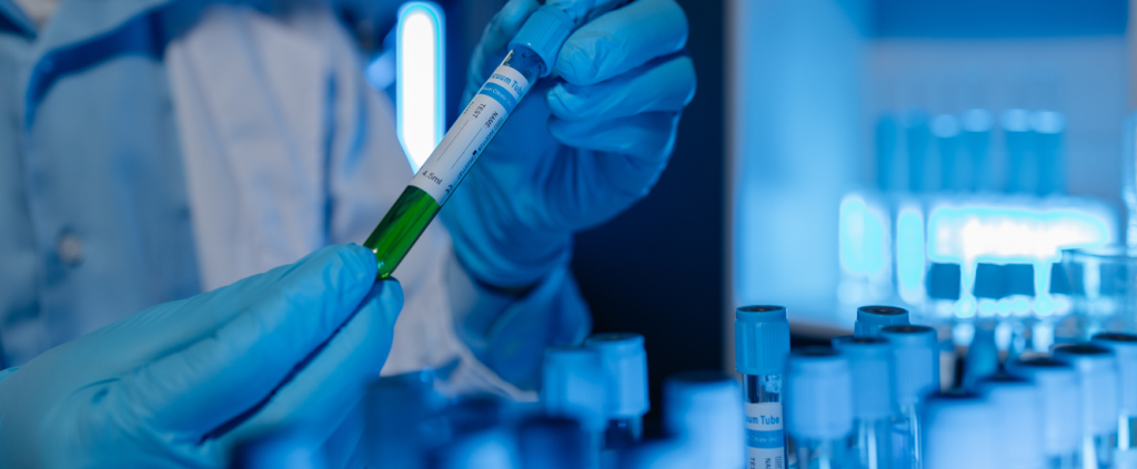 AbbVie adquire Nimble Therapeutics e fortalece pipeline de imunologia