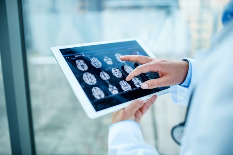Médico analisando exames de ressonância cerebral em tablet em consultório, representando tecnologia médica avançada e diagnóstico por imagens. A imagem reflete sobre gêmeos digitais na saúde.