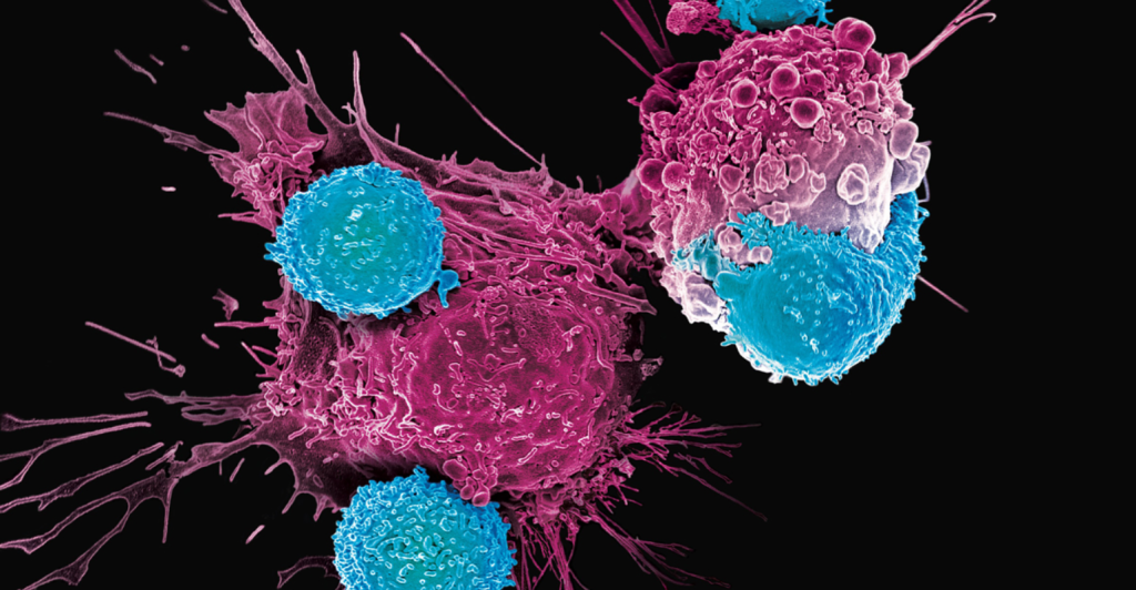 Estudo revela barreiras financeiras e estruturais para Terapia CAR-T no Brasil