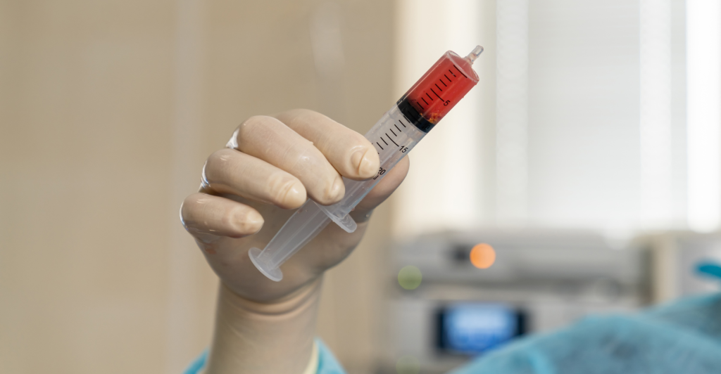 Hospital Paulistano amplia em 40% número de transplantes de medula óssea