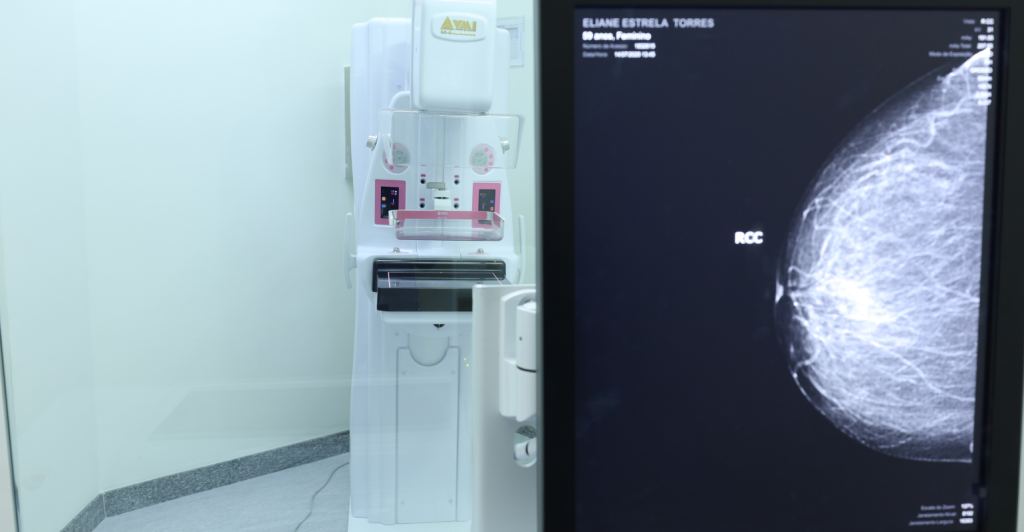 Santa Casa BH inaugura novo mamógrafo