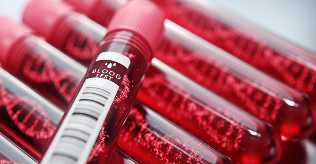 Mater Dei inova no tratamento de mieloma múltiplo com terapia CAR-T