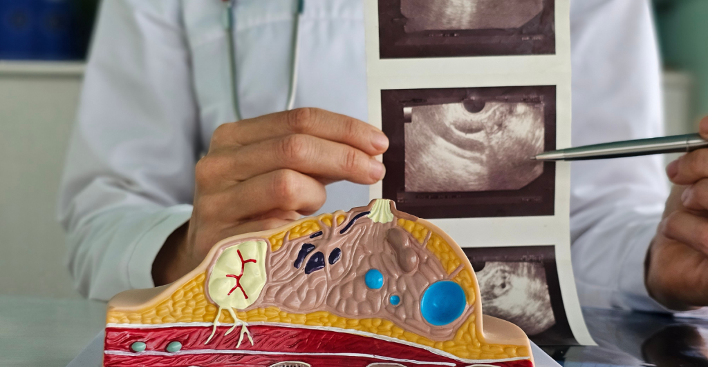 Hapvida acelera diagnóstico do câncer de mama com tecnologia preditiva