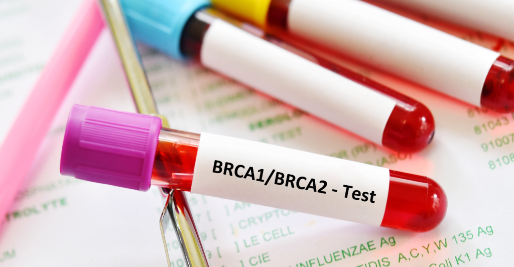 Genética e inovação: repensando a prevenção do câncer de mama