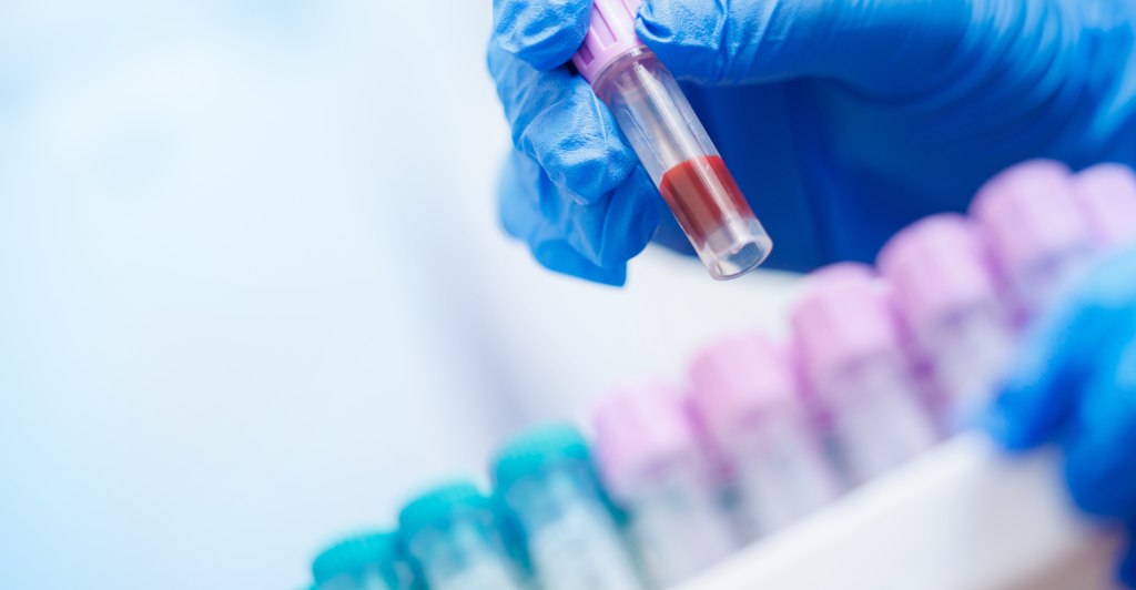 Grupo Fleury expande uso de tecnologia LDTD para otimizar análises