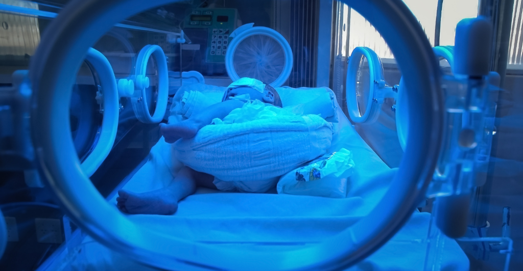 Santa Casa BH instala neuromonitoramento em UTI neo natal