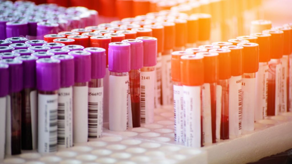 95% dos exames laboratoriais do SUS dependem da rede privada