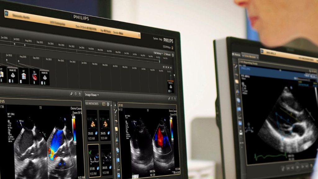 Conexão entre imagens, dados clínicos e fluxos assistenciais transforma a jornada diagnóstica em Cardiologia