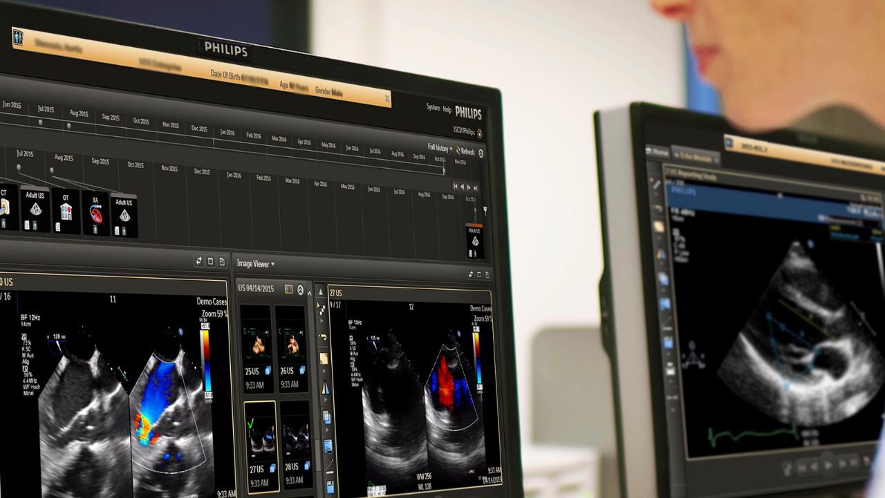 Diagnóstico integrado em Cardiologia melhora jornada do paciente